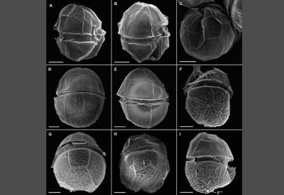 Dedican a un investigador del IEO una nueva especie de dinoflagelado tóxico Dedican a un investigador del IEO una nueva especie de dinoflagelado tóxico