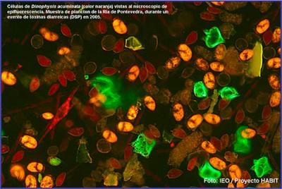 Nuevas técnicas genéticas para la detección inmediata de algunas especies de algas tóxicas