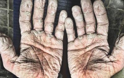 Impactante: el campeón olímpico de remo y las imágenes que dan la vuelta al mundo Impactante: el campeón olímpico de remo y las imágenes que dan la vuelta al mundo